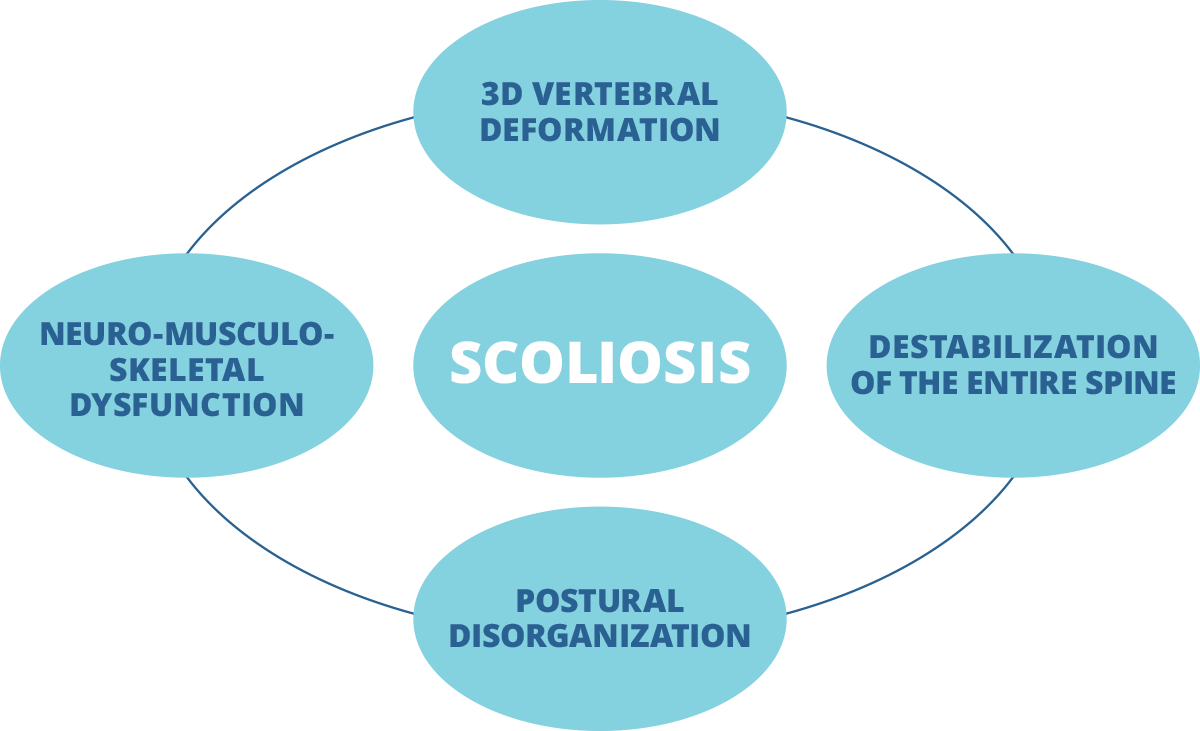 Scoliosis