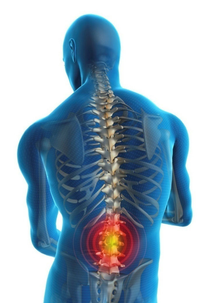 Screening for scoliosis